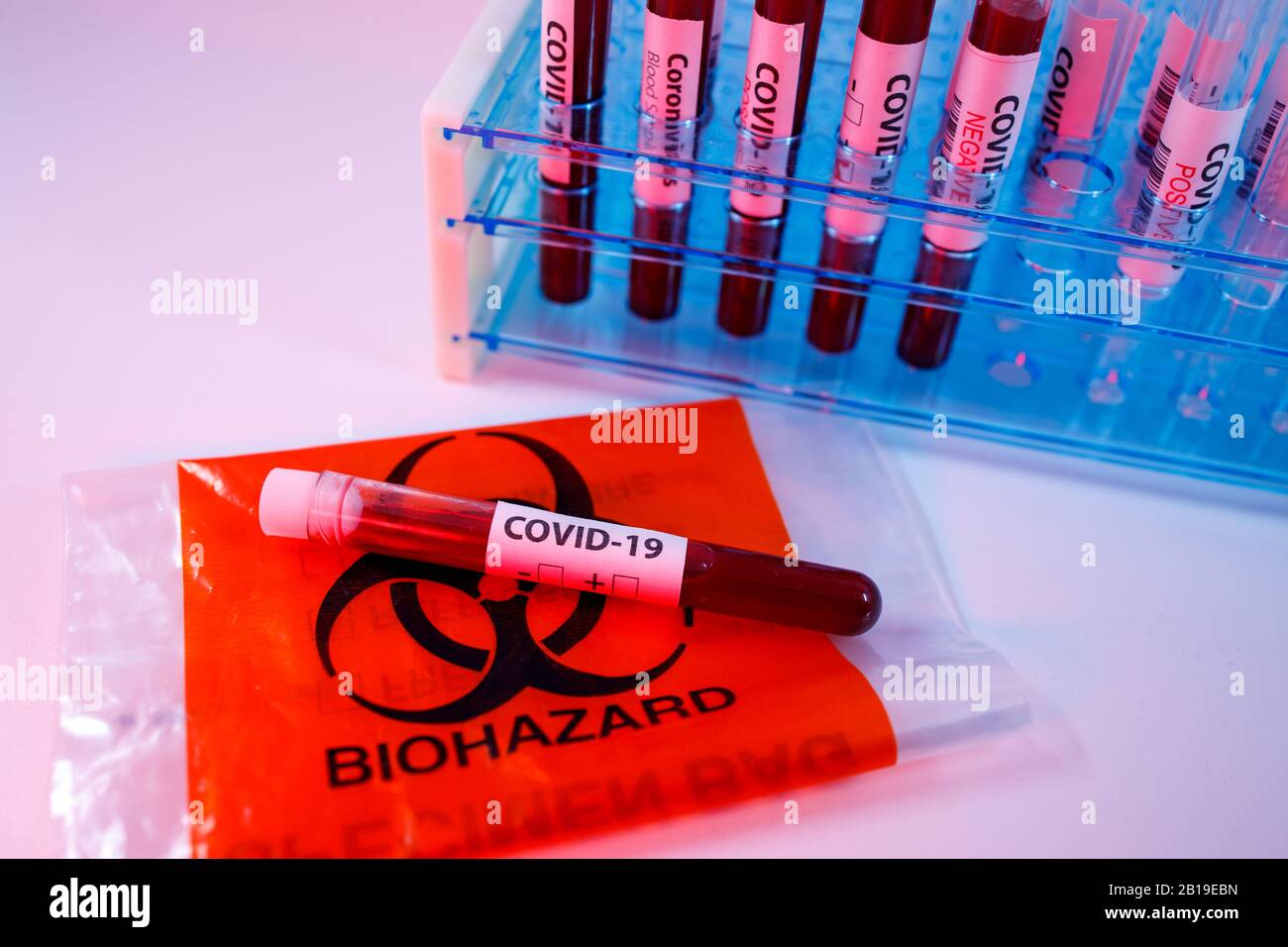 Blood sample for the rapidly spreading Coronavirus that originated in Wuhan. Test tube on an empty test request form for covid-19, biohazard transport Stock Photo