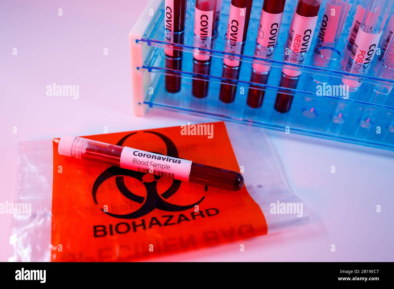 Blood sample for the rapidly spreading Coronavirus that originated in Wuhan. Test tube on an empty test request form for covid-19, biohazard transport Stock Photo