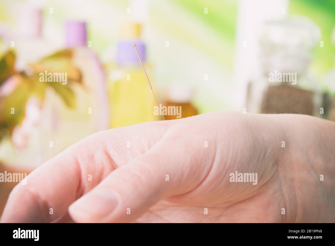 Acupuncture needle stuck in the hand. Concept of natural therapies Stock Photo Alamy