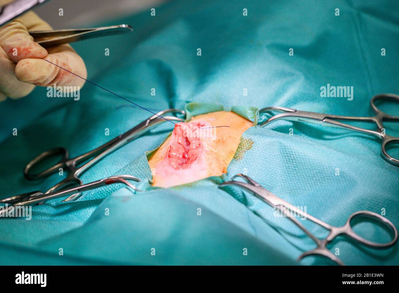 Operation process on a patient. Surgeon's hands in protective gloves doing surgery with medical tools . Stock Photo