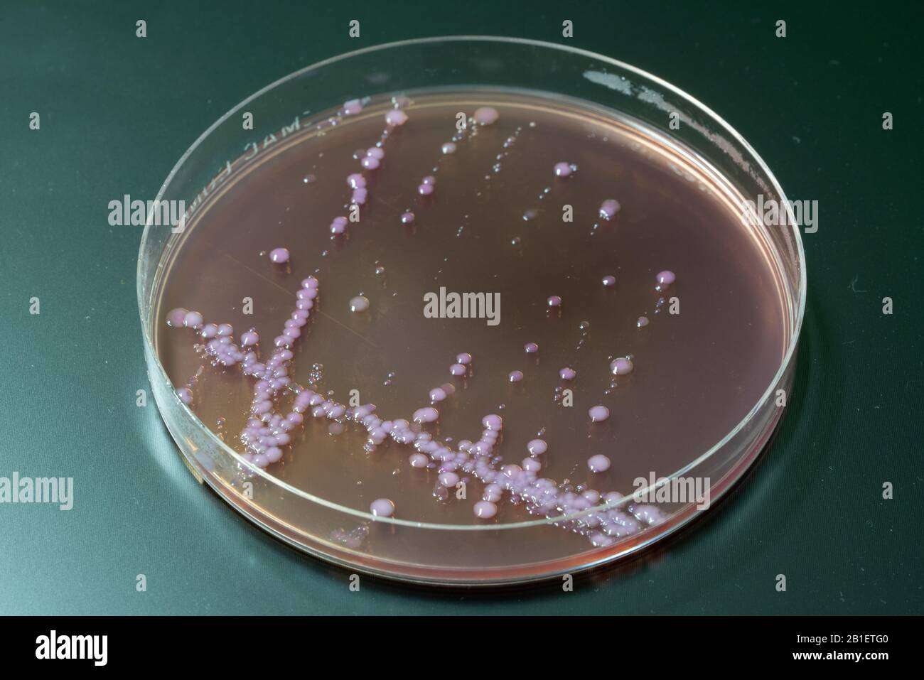 enterococcus faecalis macconkey agar