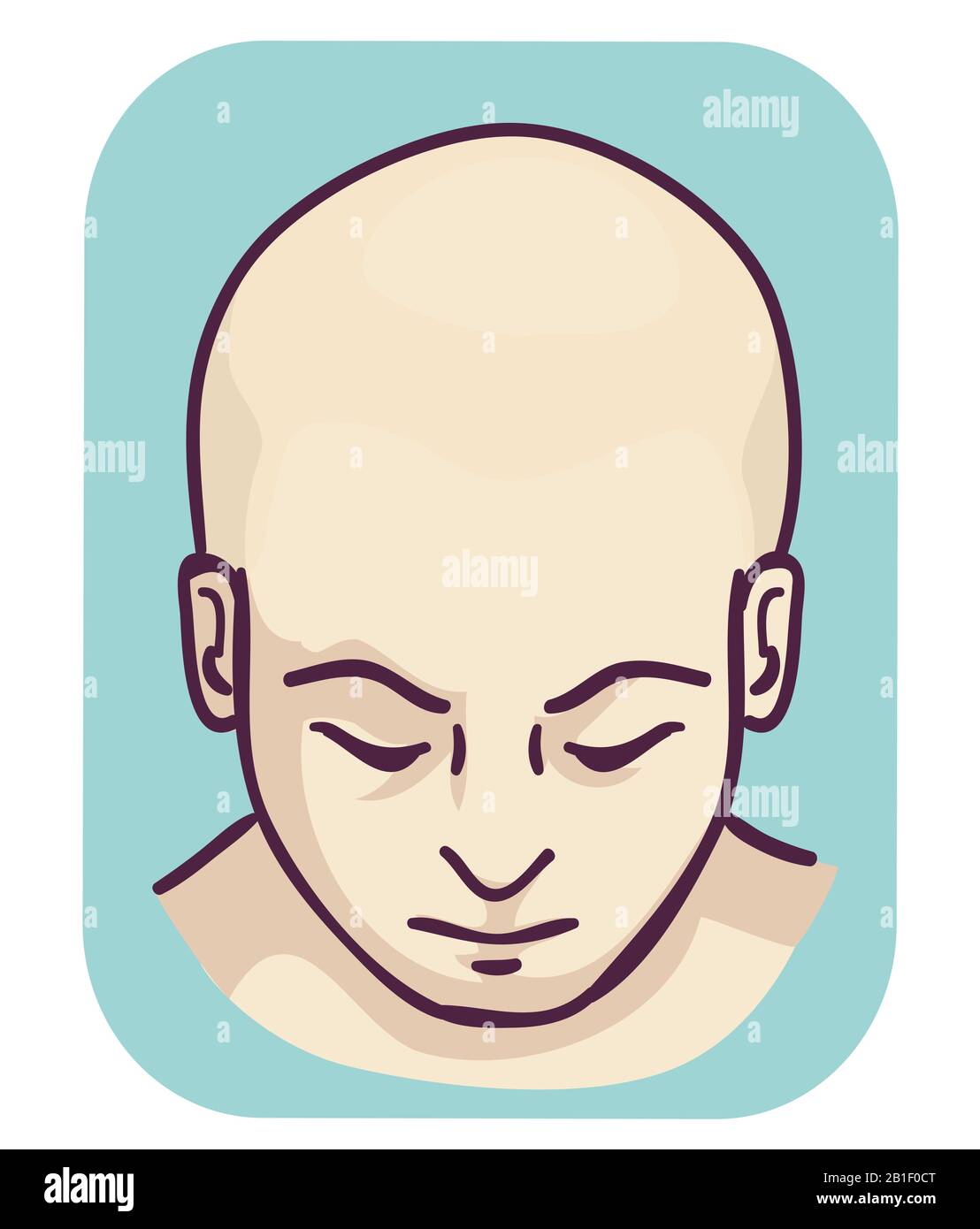 Illustration of a Man Showing a Bald Head, Full Head Hair Loss Stock Photo  - Alamy