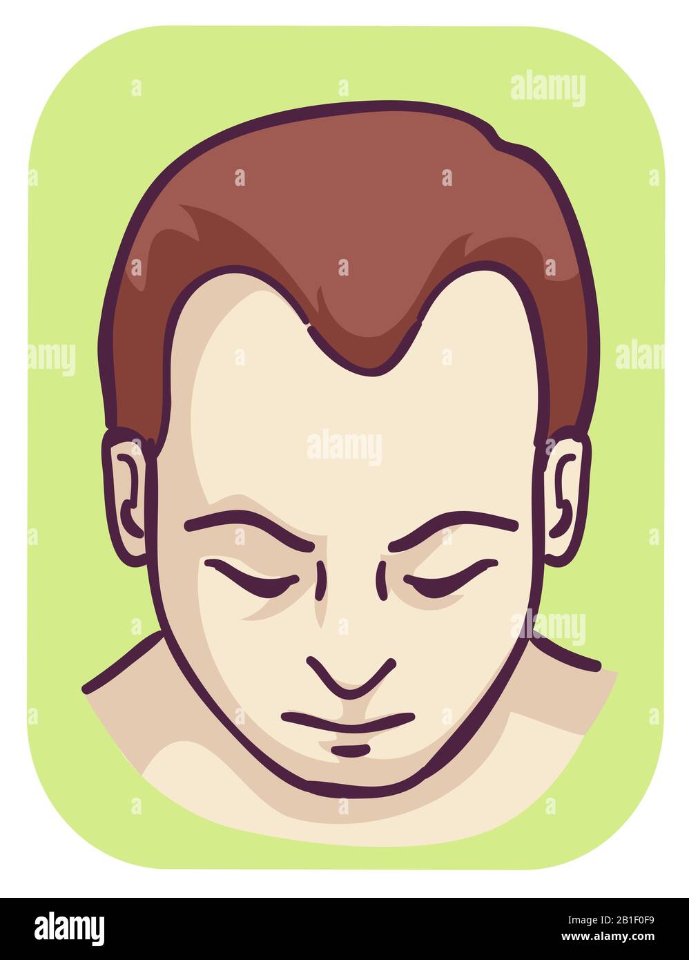Illustration of a Man with M Pattern Baldness Hairline Loss Stock Photo