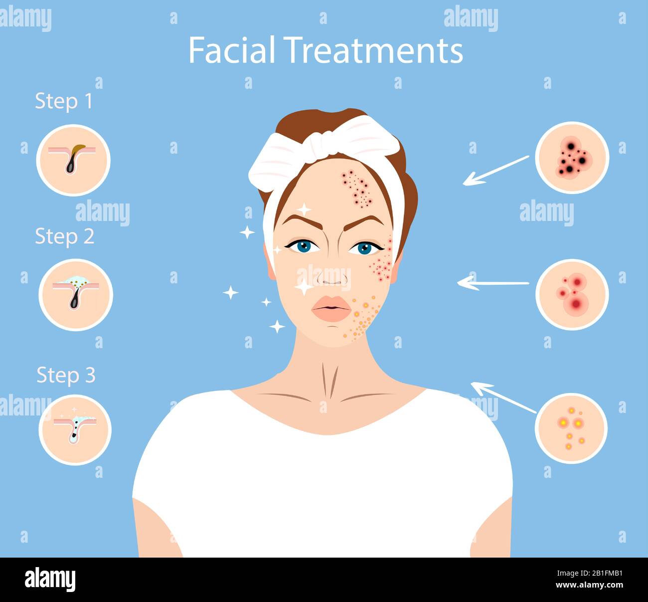 Vector of a young woman with face imperfections. Facial treatments infographic. Stock Vector