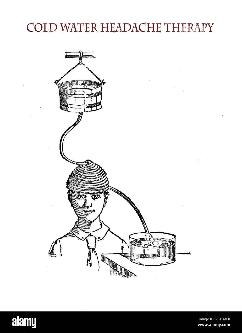 Hydrotherapy, alternative medicine cold water headache therapy