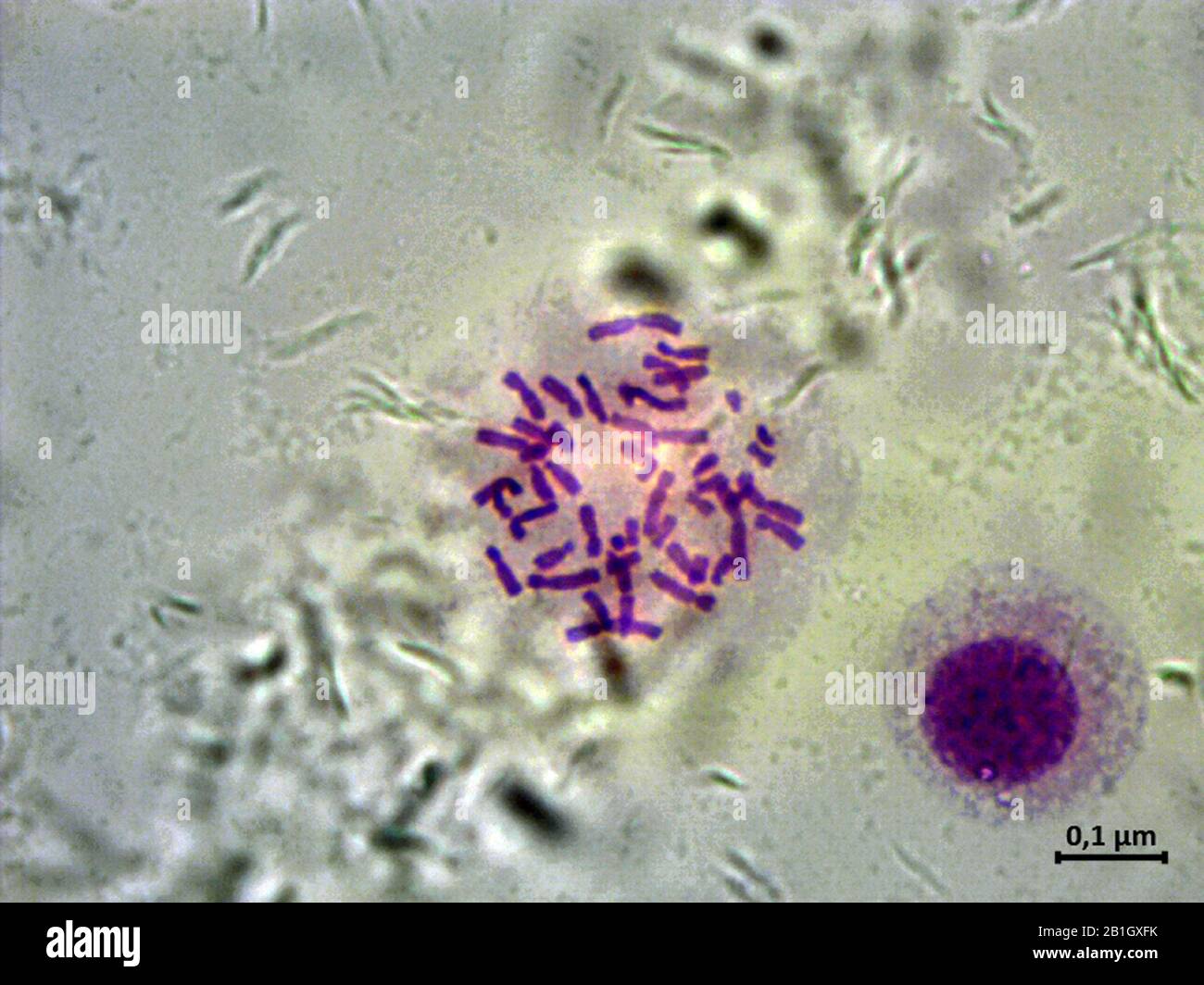 chromosome set of a man, 5000x Stock Photo