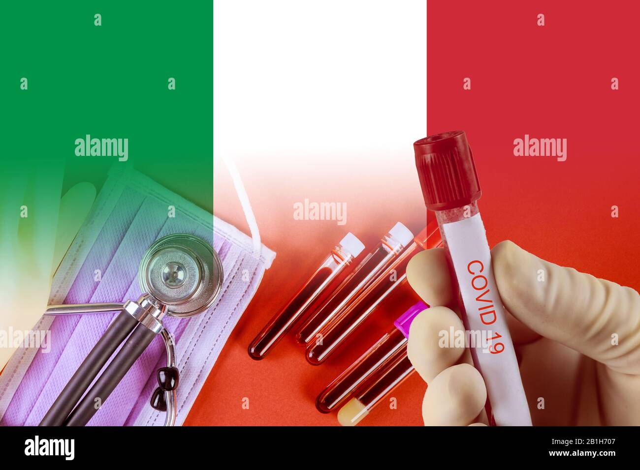 COVID19 virus definition Middle East Respiratory Syndrome Blood sample