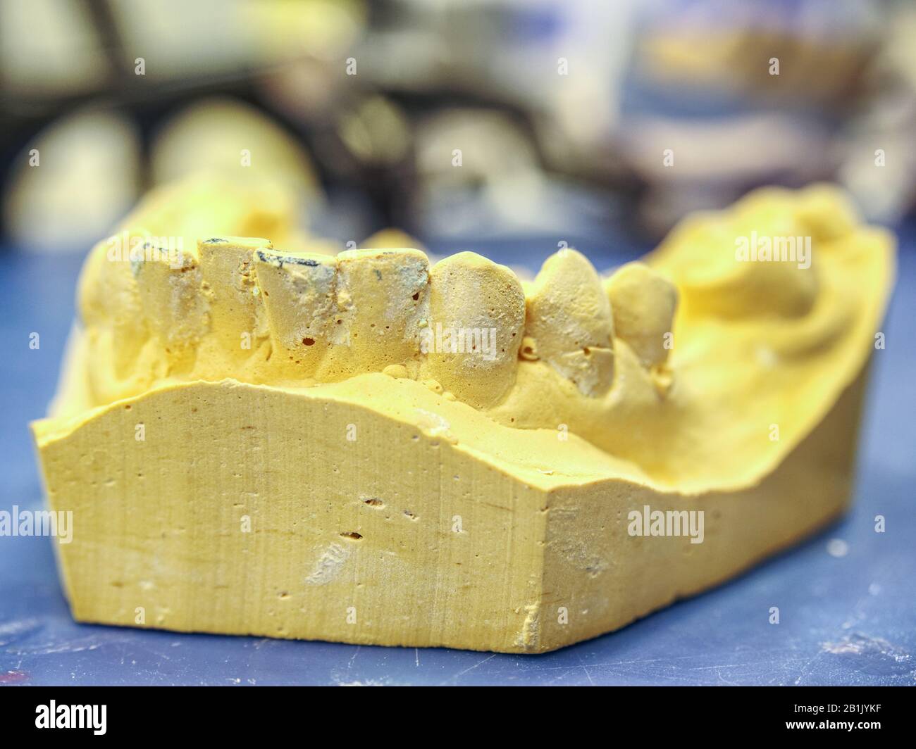 Yellow gypsum model in dental laboratory. Orthopedic dentistry