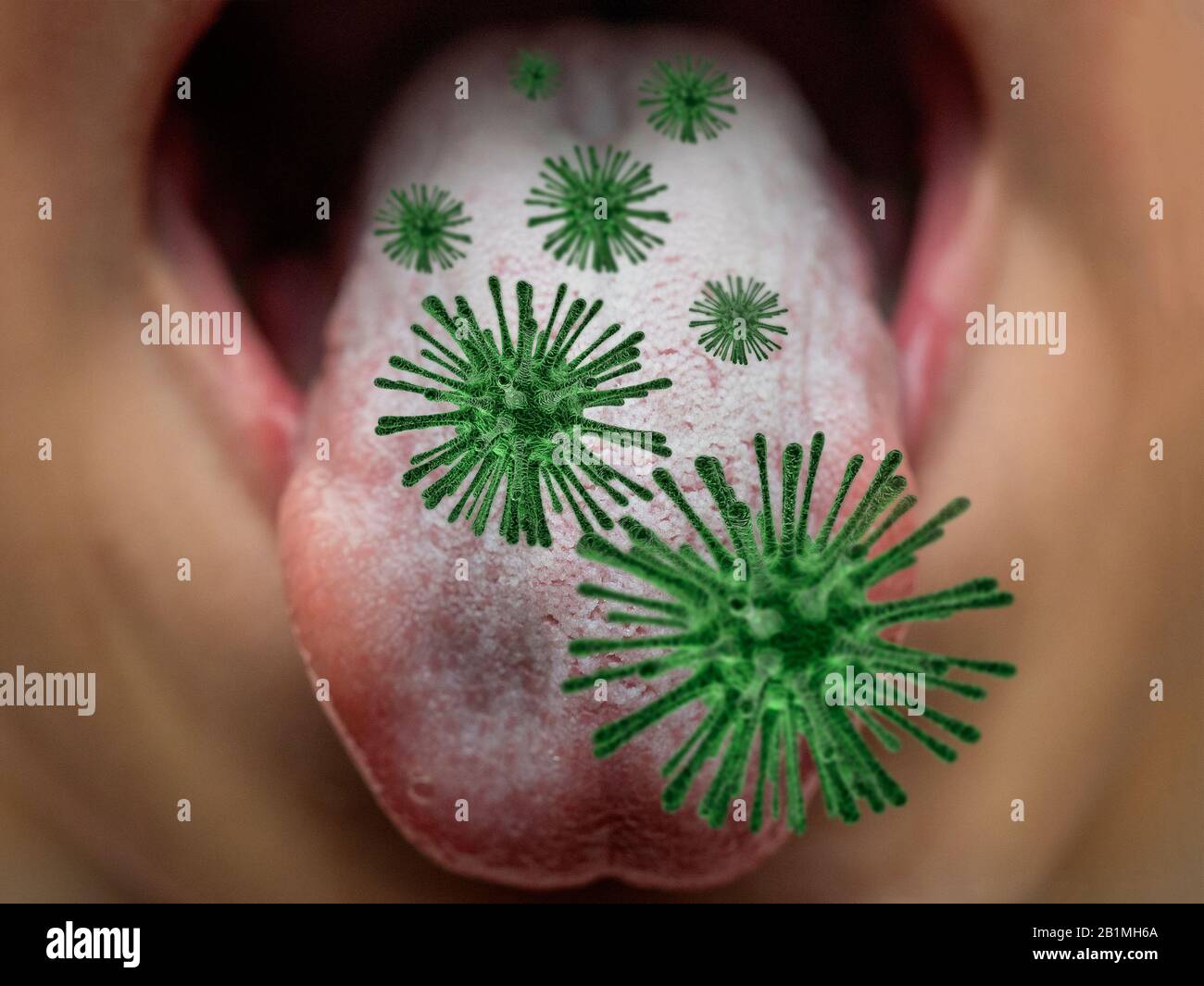 Closeup or macro shot infected by bacteria kid or children tongue