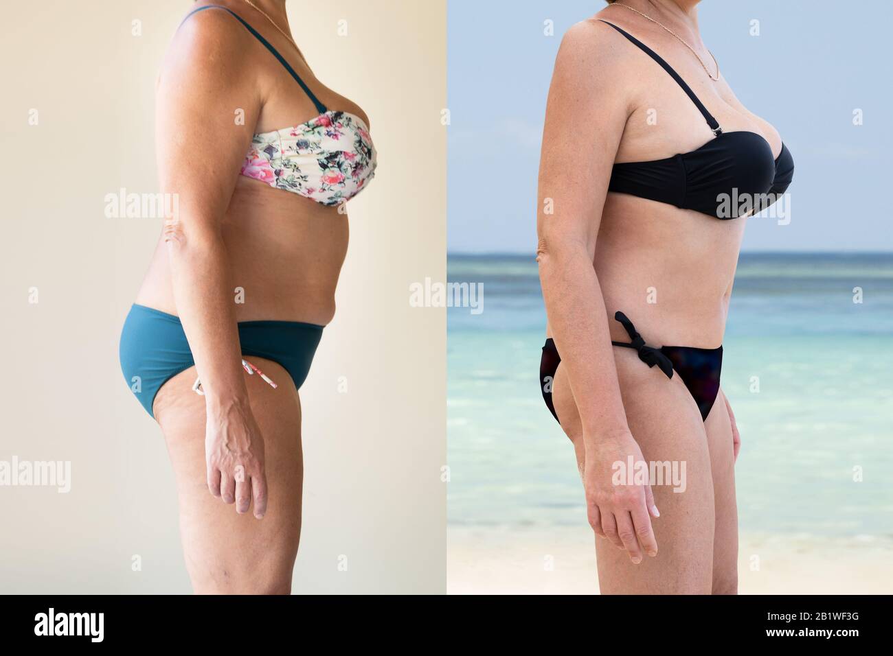 Fat Woman Bikini Beach High Resolution Stock Photography and Images - Alamy