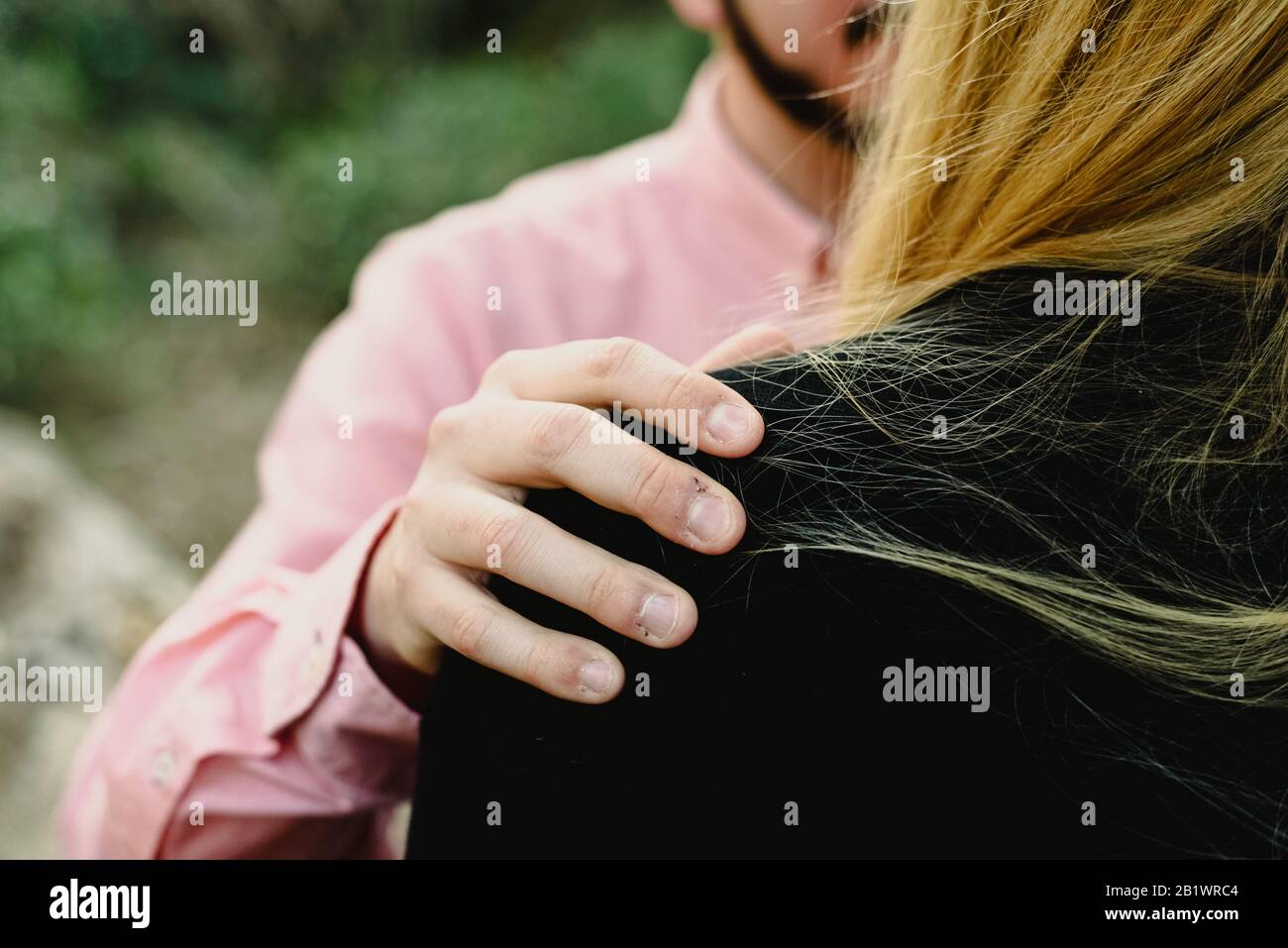 Detail of man's hand with wounds on his wife's shoulder, unfocused unfocused background, marriage disputes and machismo. Stock Photo