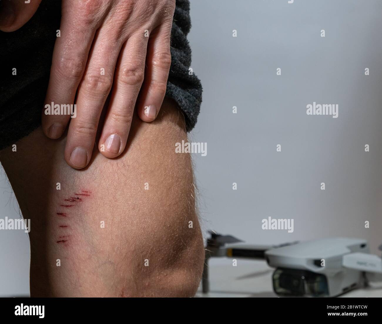 Male body scar hi-res stock photography and images - Alamy