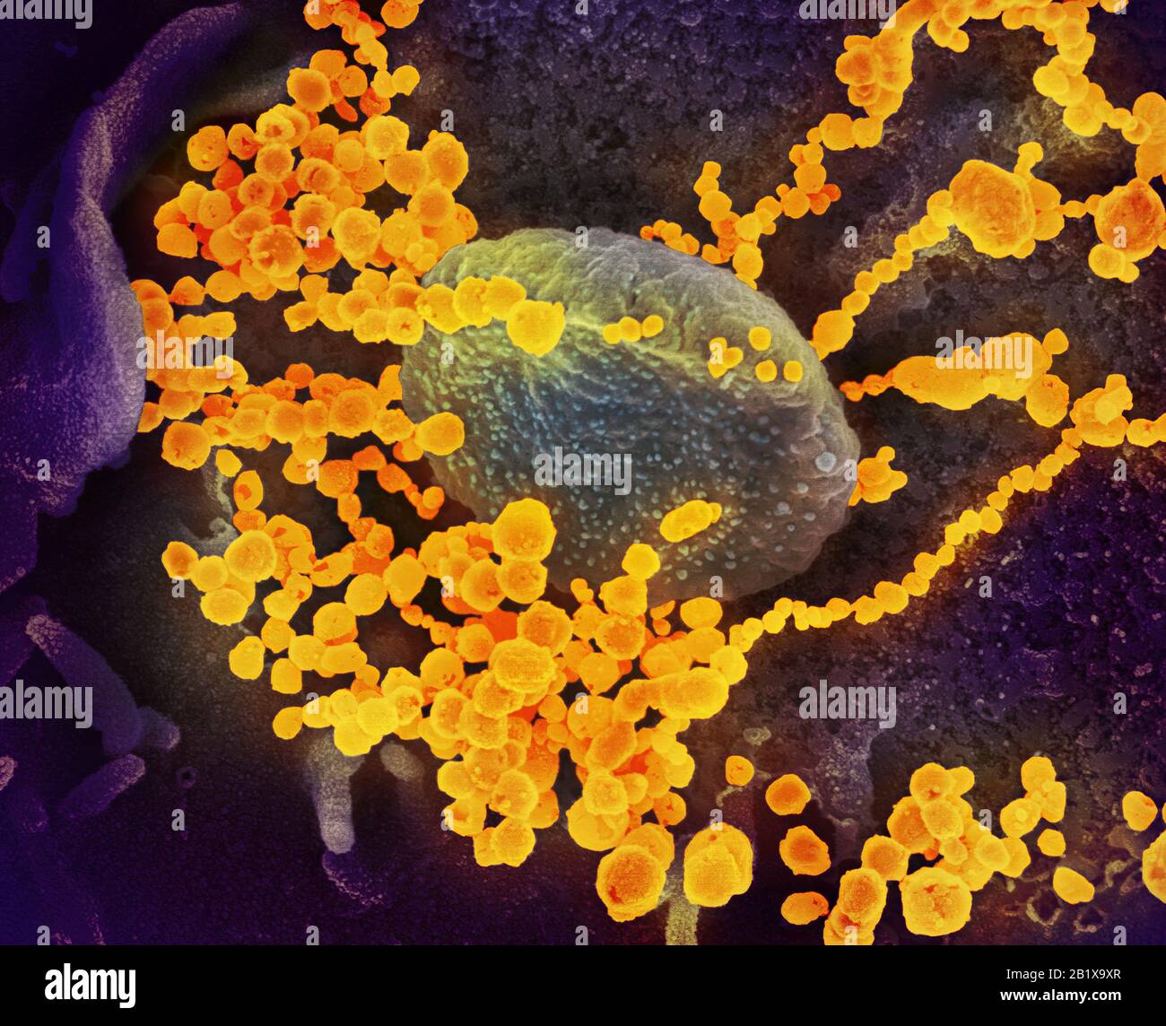 COVID-19. Novel Coronavirus SARS-CoV-2  This scanning electron microscope image shows SARS-CoV-2 (round gold objects) emerging from the surface of cells cultured in the lab. SARS-CoV-2, also known as 2019-nCoV, is the virus that causes COVID-19. The virus shown was isolated from a patient in the U.S. Credit: NIAID-RML Stock Photo