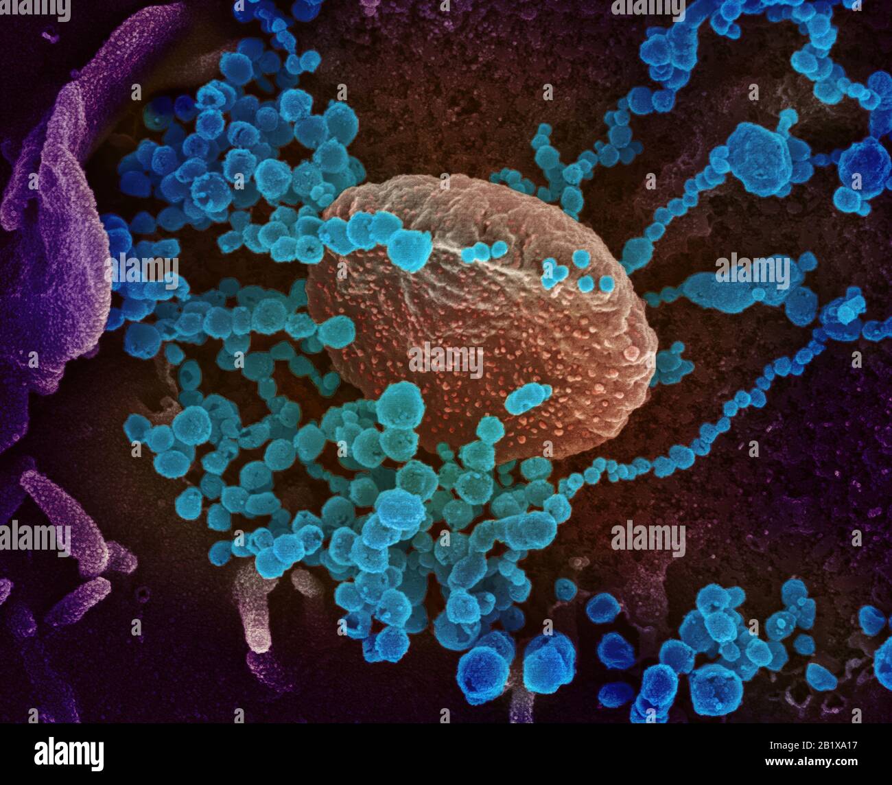 COVID-19. Novel Coronavirus SARS-CoV-2  This scanning electron microscope image shows SARS-CoV-2 (round blue objects) emerging from the surface of cells cultured in the lab. SARS-CoV-2, also known as 2019-nCoV, is the virus that causes COVID-19. The virus shown was isolated from a patient in the U.S. Credit: NIAID-RML Stock Photo
