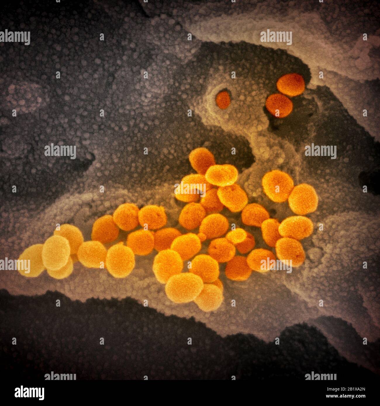 Novel Coronavirus SARS-CoV-2  COVID-19. This scanning electron microscope image shows SARS-CoV-2 (orange)—also known as 2019-nCoV, the virus that causes COVID-19—isolated from a patient in the U.S., emerging from the surface of cells (gray) cultured in the lab. Credit: NIAID-RML Stock Photo