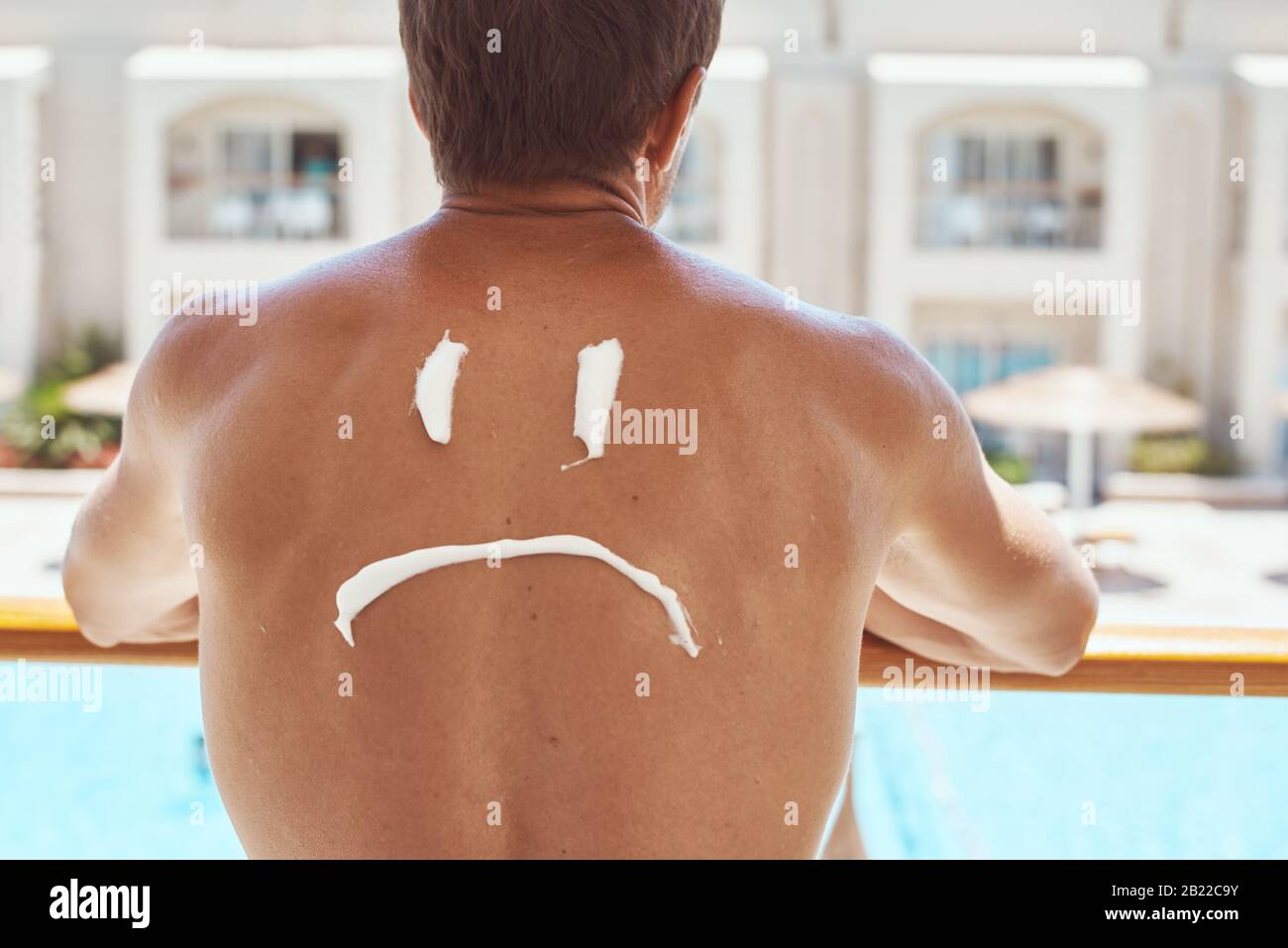 Sad smile painted on man back with sunscreen. Sunburn protection concept  Stock Photo - Alamy
