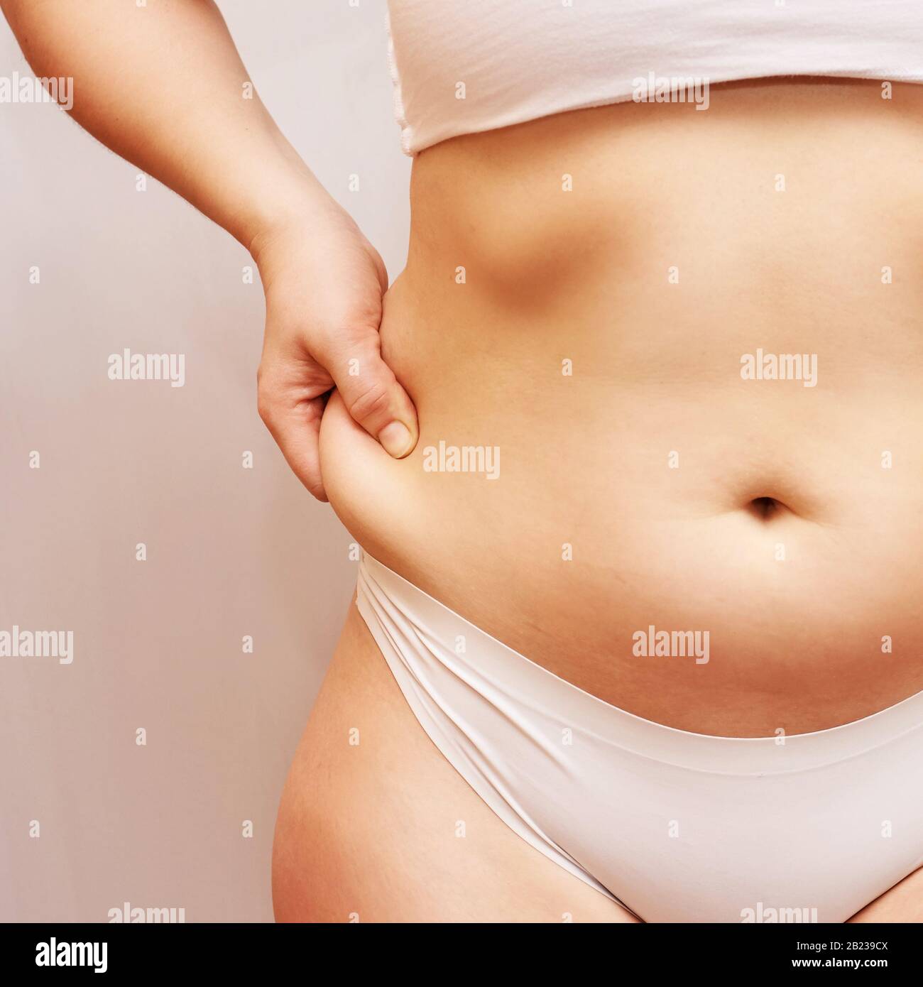 Fat unhealthy woman body. Pinch belly side. Measurement lady procedure. Medicine Stock Photo