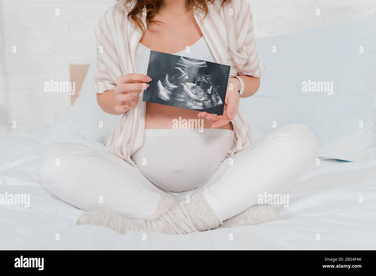 Cropped view of pregnant woman holding ultrasound scan of baby while