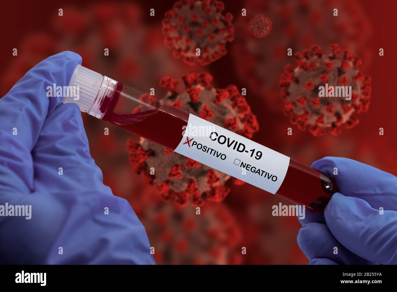 Hands holding blood sample in vacuum tube with Positive Coronavirus analysis 2019-nCoV Stock Photo