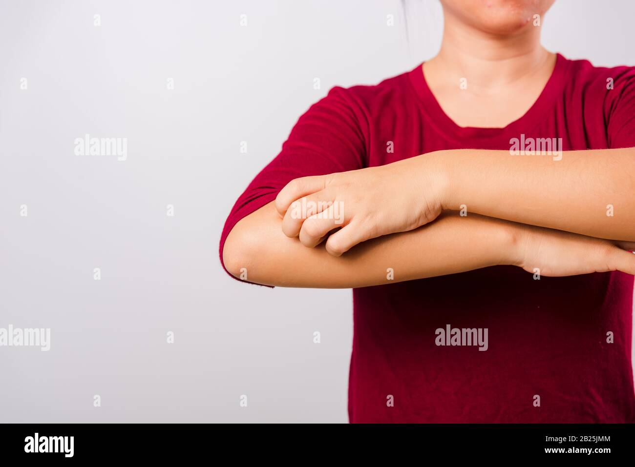 Asian beautiful woman itching her scratching her itchy arm on white background with copy space, Medical and Healthcare concept Stock Photo