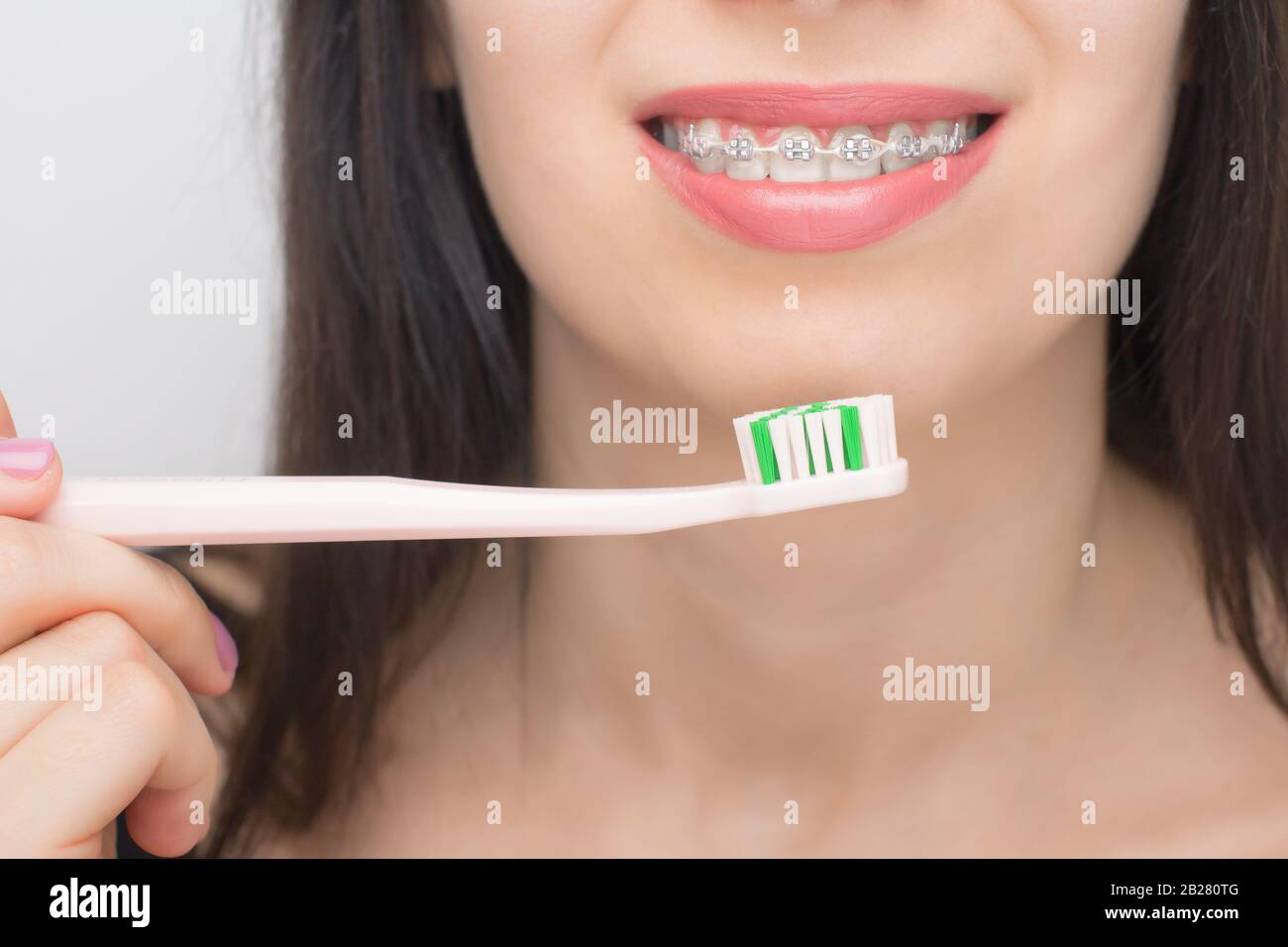 Cleaning teeth with dental braces by pink brush. Happy woman with brackets on the teeth after