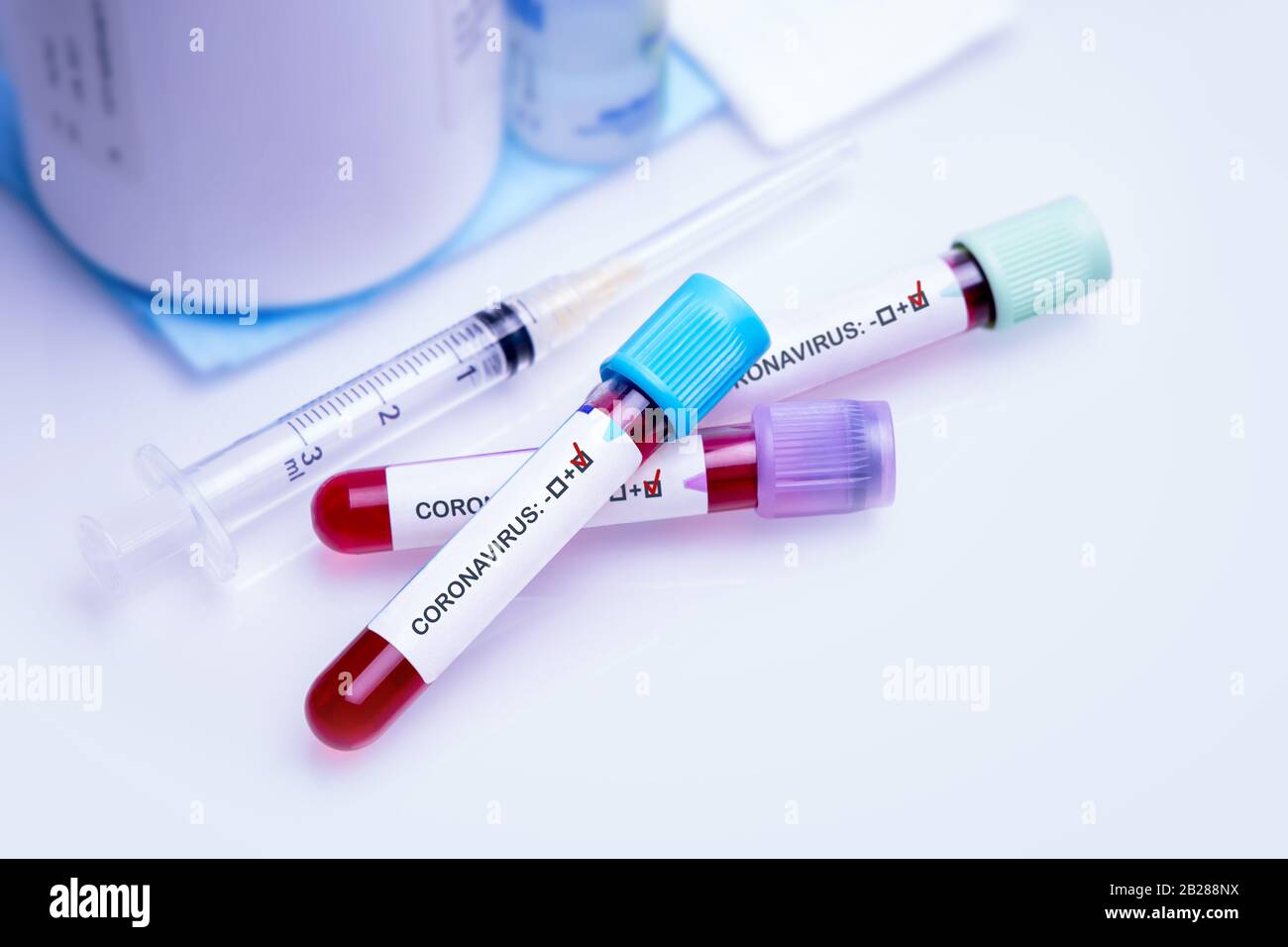 Positive blood test in vacuum tube for the new rapidly spreading Coronavirus COVID-19 biochemical analysis. Coronavirus concept. Stock Photo