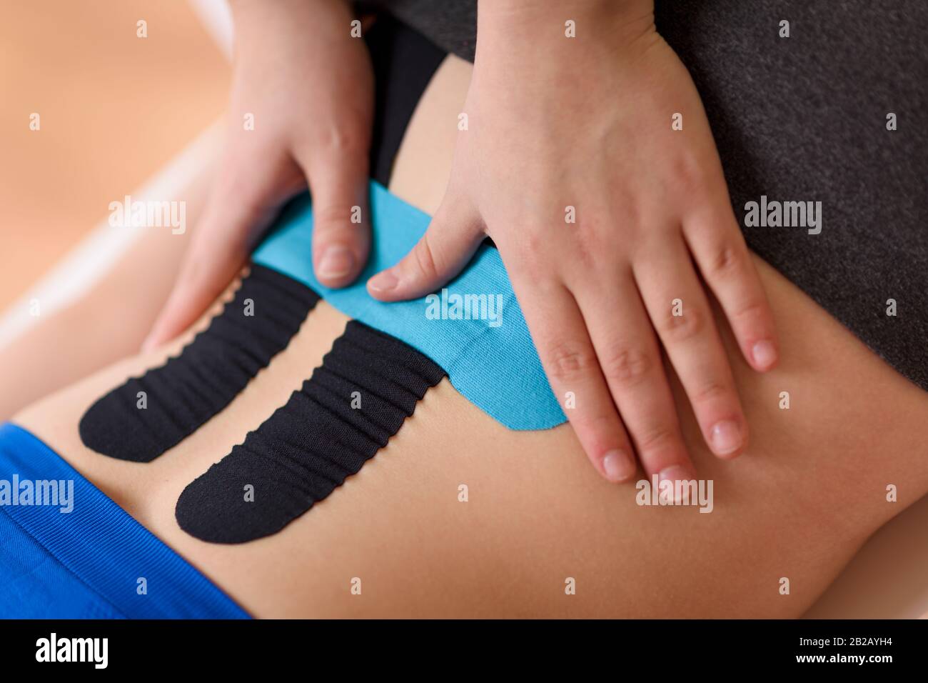 Physical therapist applying kinesio tape on female patient's lower back