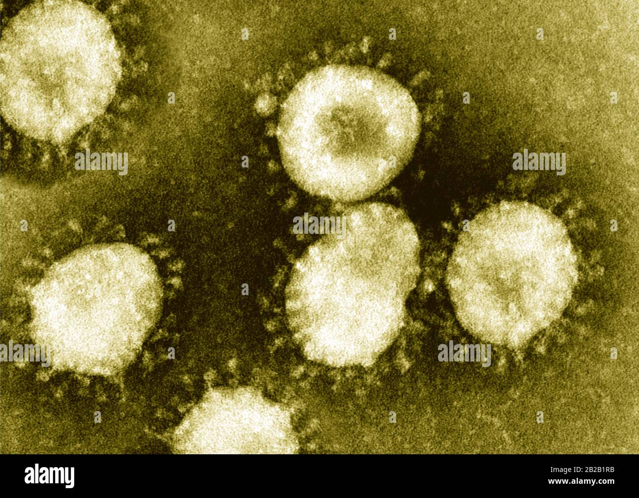 detail of ultraestructure of deadly coronavirus particles under transmission electron microscopy (TEM). Stock Photo