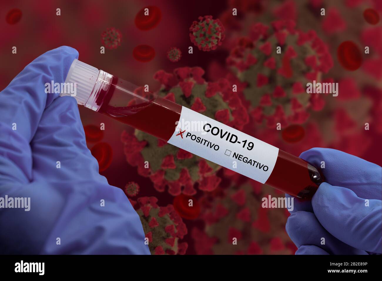 Hands holding blood sample in vacuum tube with Positive Coronavirus analysis 2019-nCoV over a simulation of infected blood, view through a microscope. Stock Photo