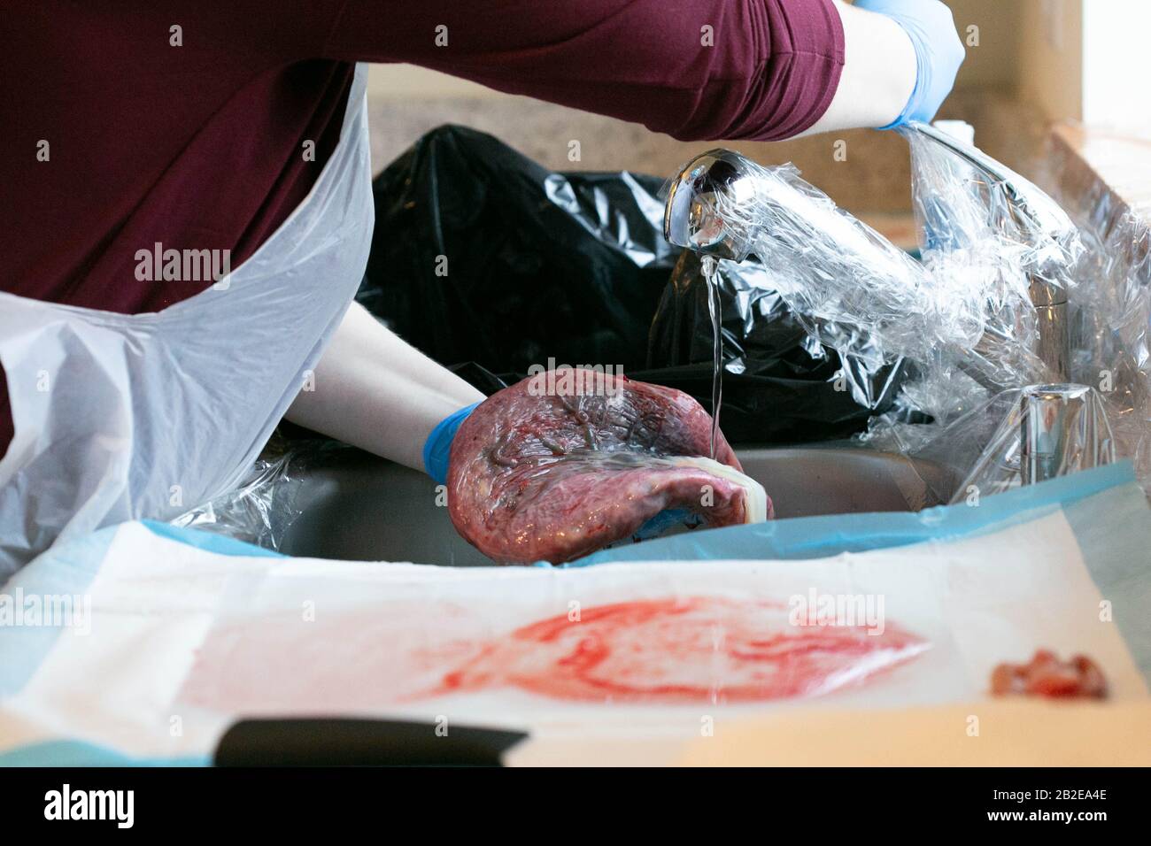 Gloved hands rinsing placenta in sink. Stock Photo