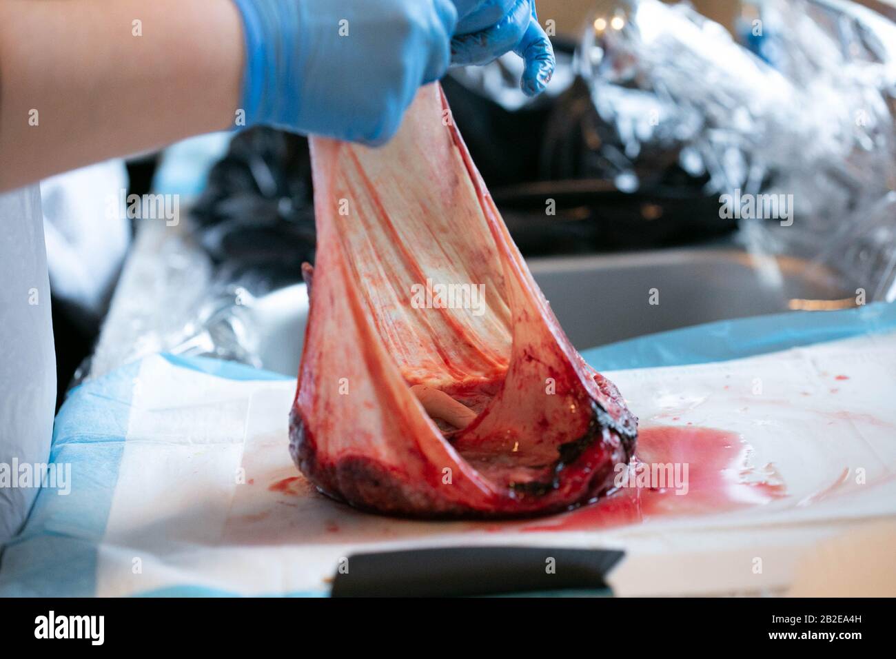 Aminiotic sac visible still attached to placenta Stock Photo