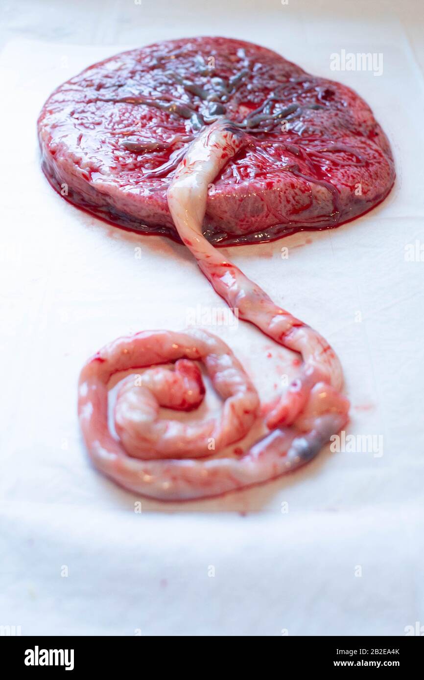 Close up shot of placenta on white background umbilical cord visible. Stock Photo