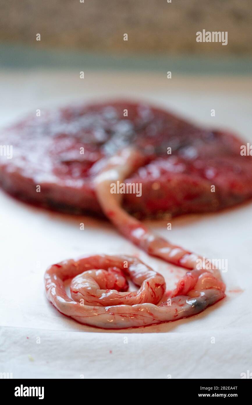 Close up umbilical cord after birth still attached to placenta. Stock Photo