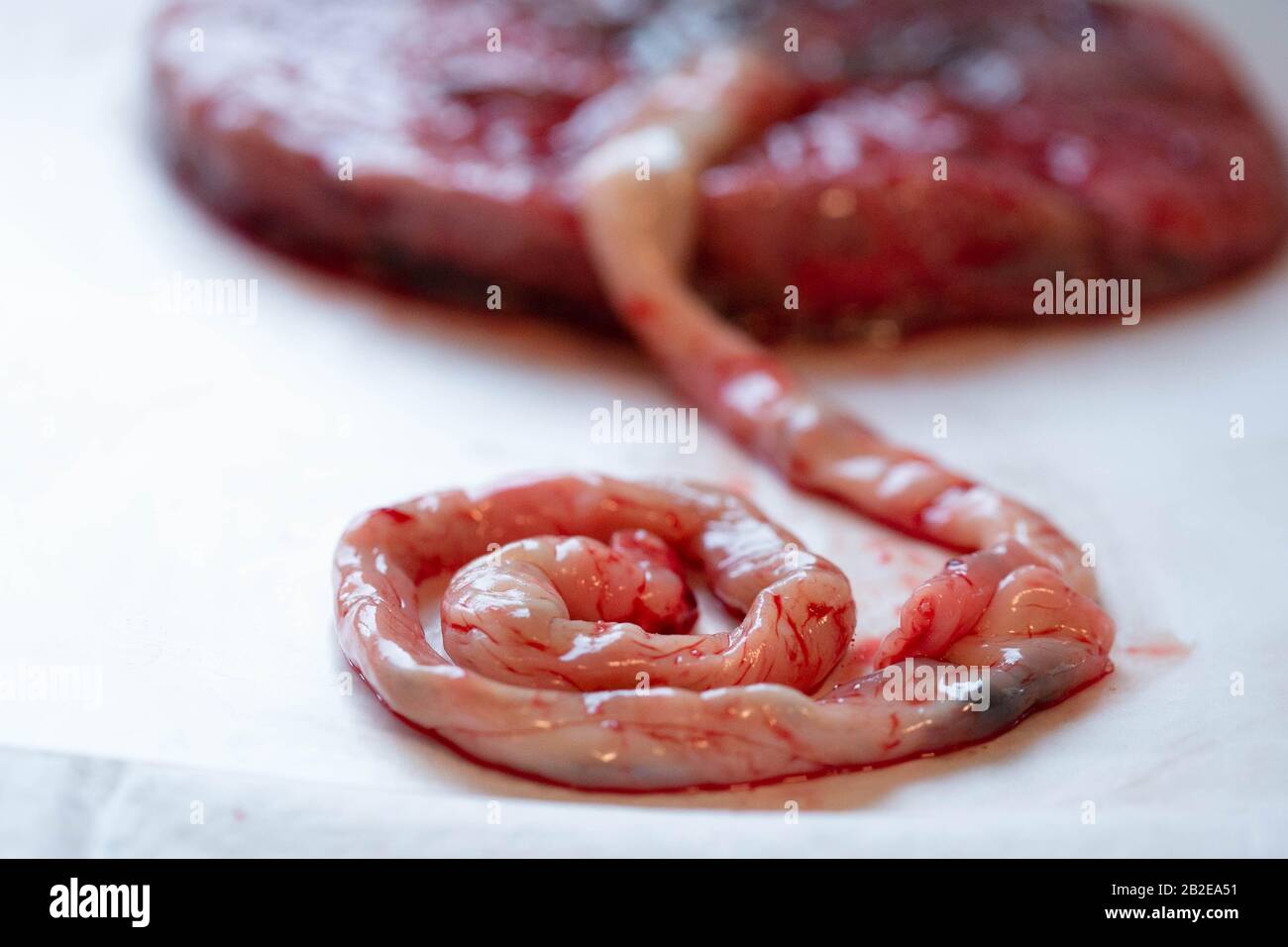 Close up of umbilical cord still attached to placenta visible vessels. Stock Photo