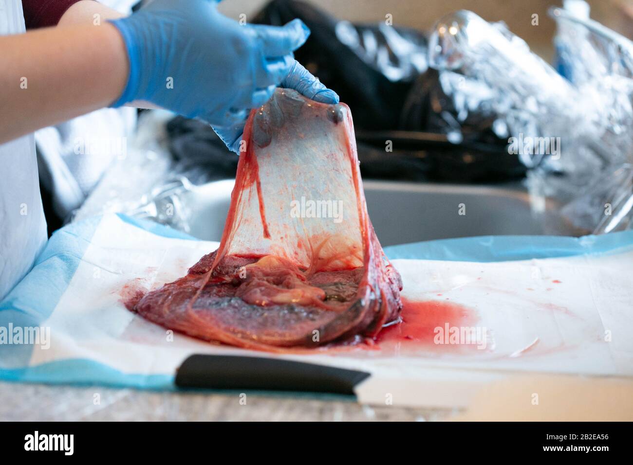 Gloved hands holding open amniotic sac attached to placenta. Stock Photo