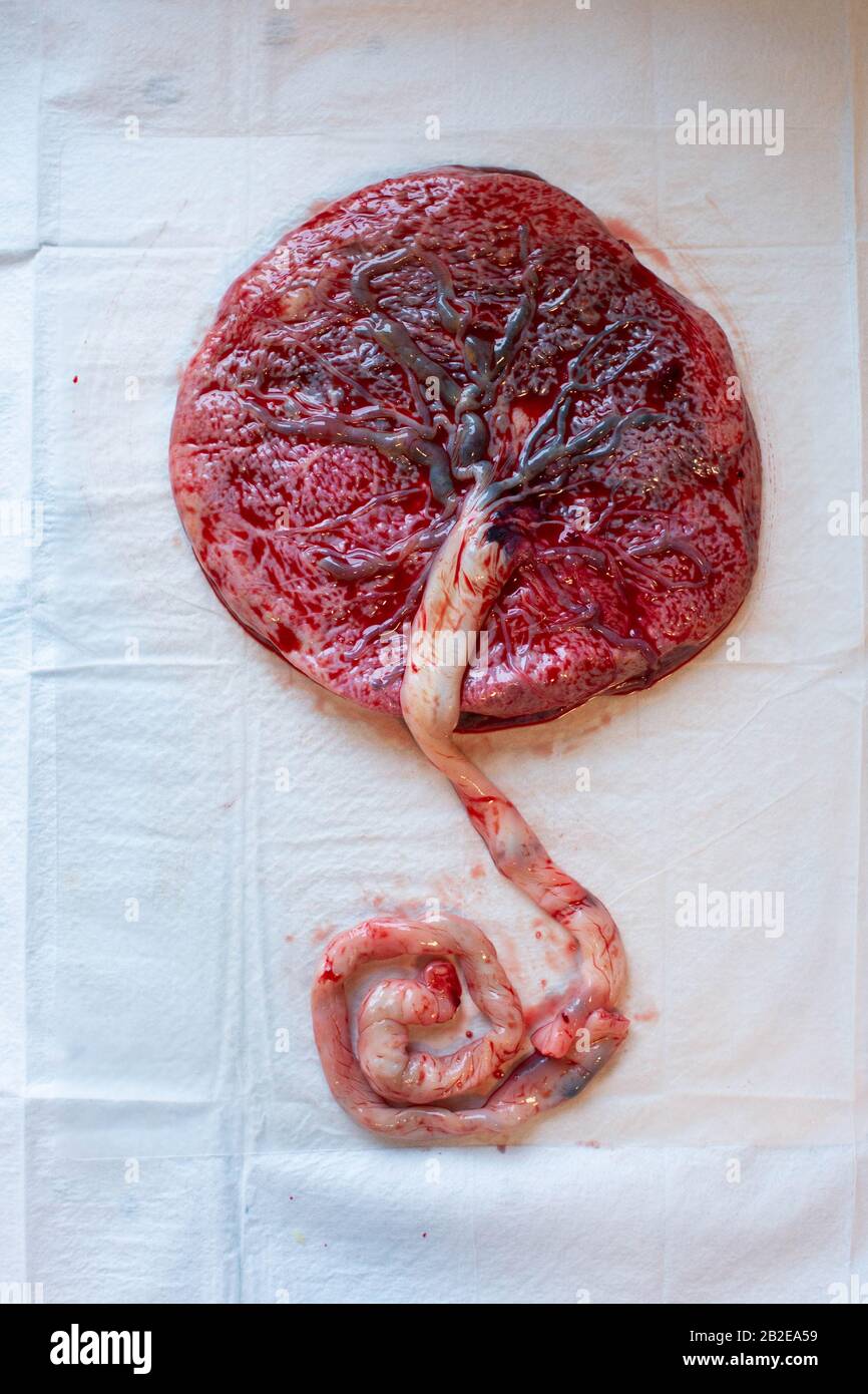 Human placenta with veins and umbilical cord visible. Stock Photo