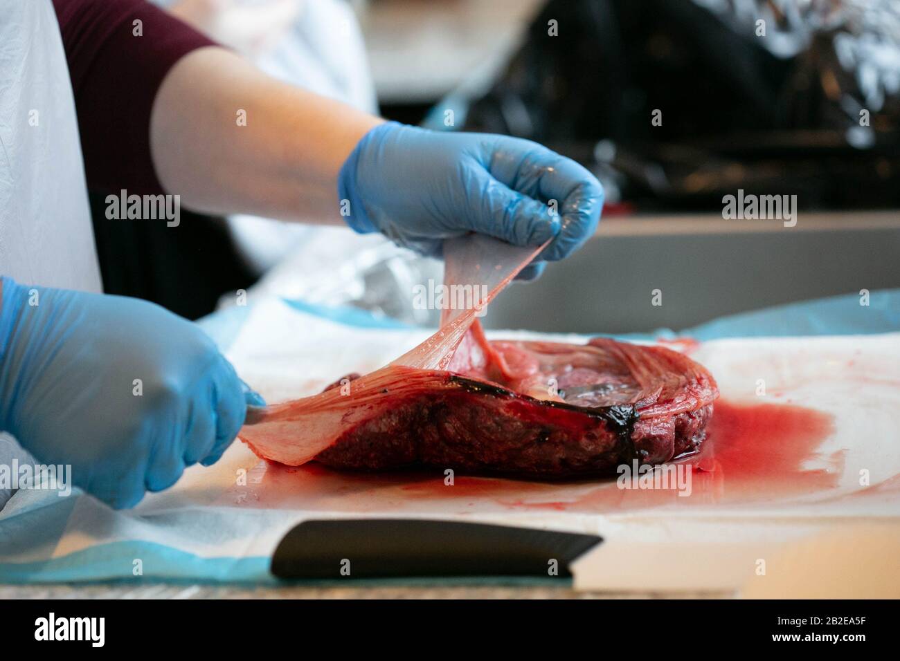Person with close pulling apart amniotic sac from placenta. Stock Photo
