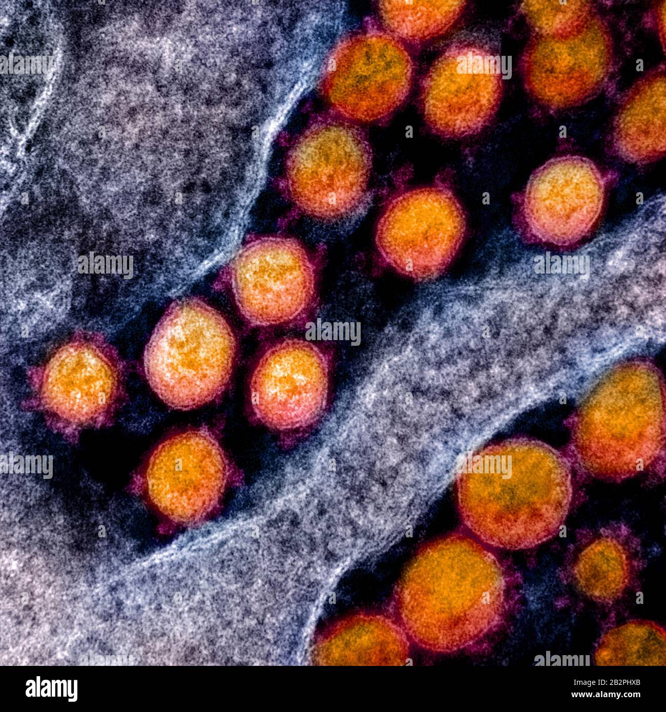 A transmission electron micrograph of COVID-19, novel coronavirus, virus particles, isolated from a patient captured and color-enhanced at the NIAID Integrated Research Facility February 28, 2020 in Fort Detrick, Maryland. Stock Photo