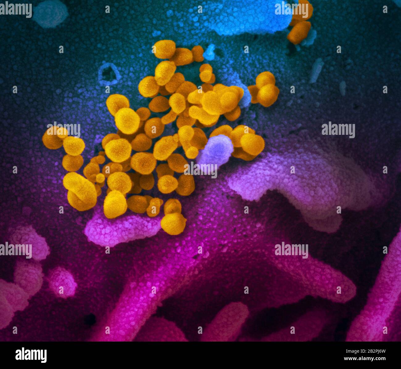 A transmission electron micrograph of COVID-19, novel coronavirus, virus particles, isolated from a patient captured and color-enhanced at the NIAID Integrated Research Facility February 12, 2020 in Fort Detrick, Maryland. Stock Photo