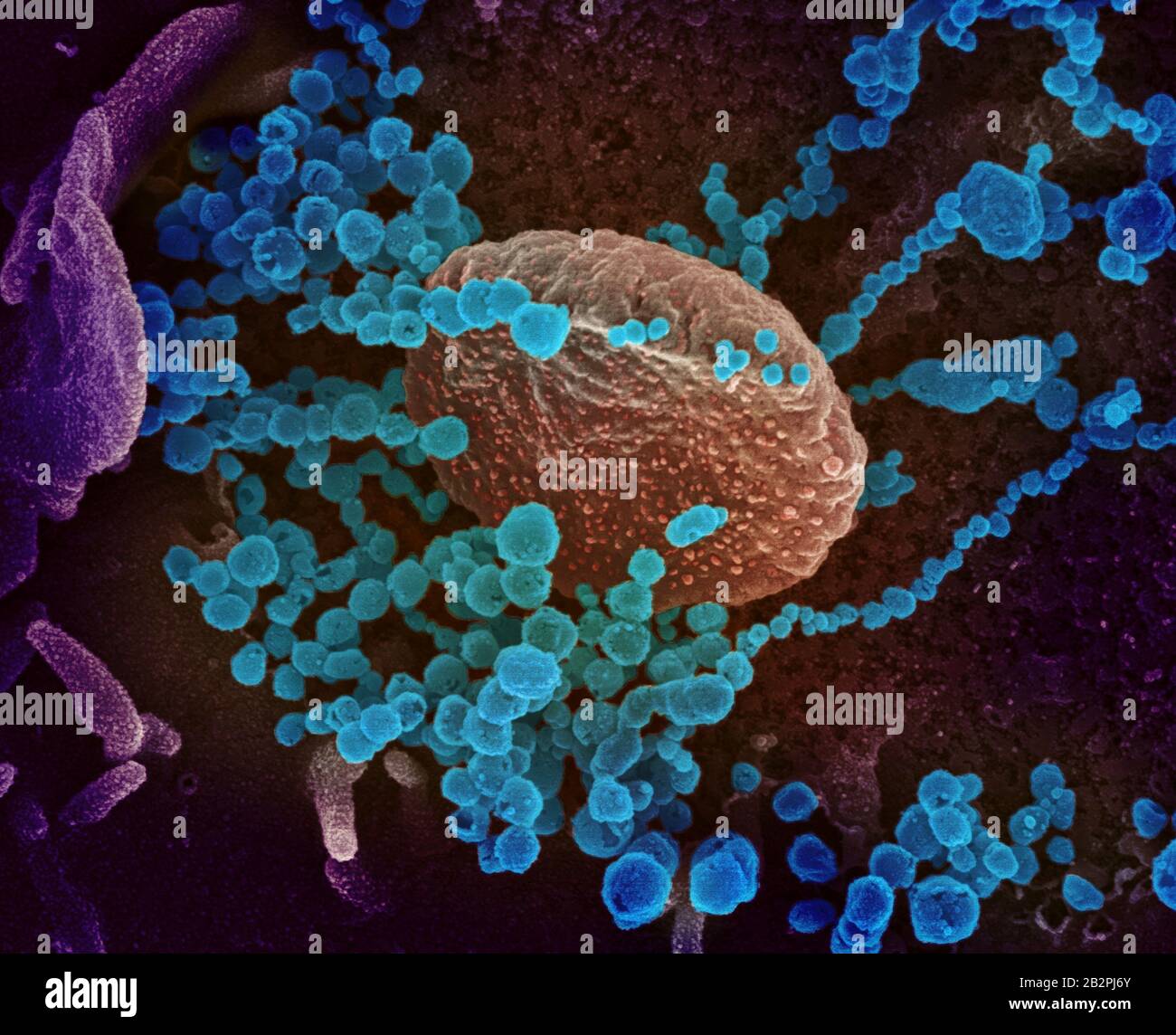A transmission electron micrograph of COVID-19, novel coronavirus, virus particles, isolated from a patient captured and color-enhanced at the NIAID Integrated Research Facility February 14, 2020 in Fort Detrick, Maryland. Stock Photo
