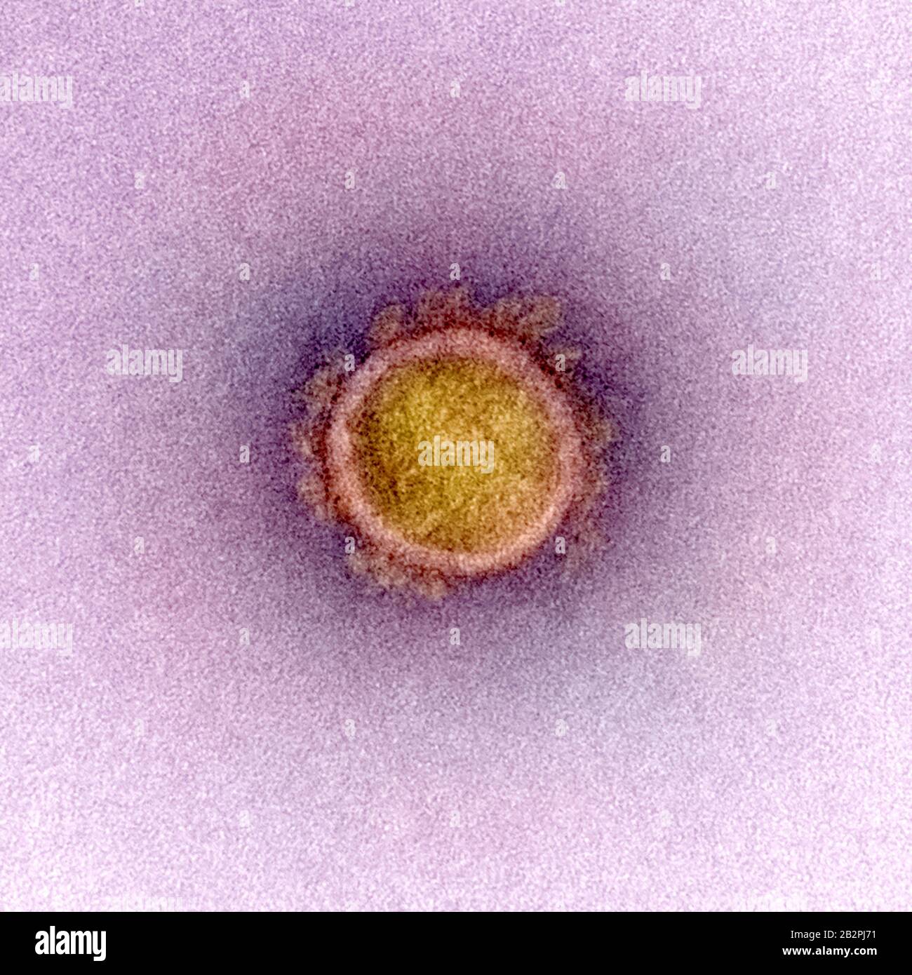 A transmission electron micrograph of COVID-19, novel coronavirus, virus particles, isolated from a patient captured and color-enhanced at the NIAID Integrated Research Facility February 24, 2020 in Fort Detrick, Maryland. Stock Photo