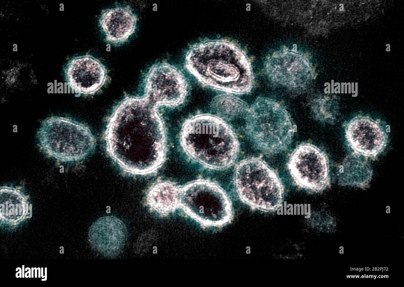 A transmission electron micrograph of COVID-19, novel coronavirus, virus particles, isolated from a patient captured and color-enhanced at the NIAID Integrated Research Facility February 14, 2020 in Fort Detrick, Maryland. Stock Photo