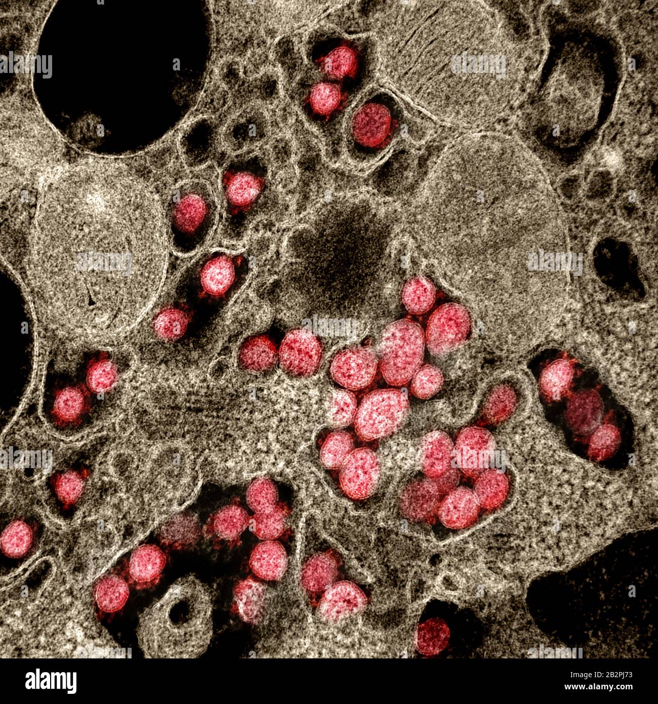 A transmission electron micrograph of COVID-19, novel coronavirus, virus particles, isolated from a patient captured and color-enhanced at the NIAID Integrated Research Facility February 28, 2020 in Fort Detrick, Maryland. Stock Photo