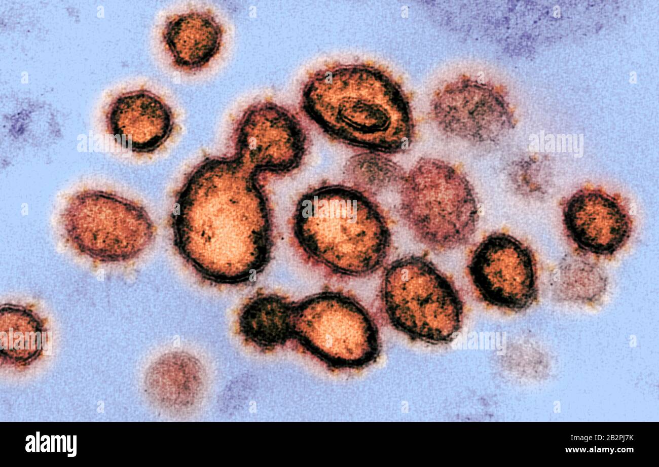 A transmission electron micrograph of COVID-19, novel coronavirus, virus particles, isolated from a patient captured and color-enhanced at the NIAID Integrated Research Facility February 14, 2020 in Fort Detrick, Maryland. Stock Photo