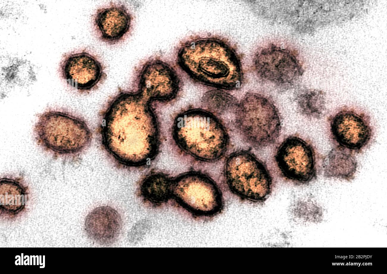 A transmission electron micrograph of COVID-19, novel coronavirus, virus particles, isolated from a patient captured and color-enhanced at the NIAID Integrated Research Facility February 14, 2020 in Fort Detrick, Maryland. Stock Photo