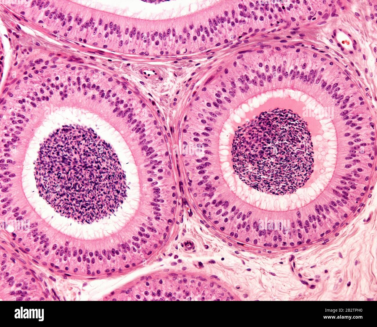 Two sections of the epididymal duct surrounded by concentric layers of fibromuscular tissue. The pseudostratified epithelium consists of tall columnar Stock Photo