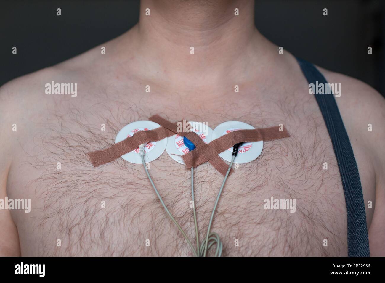 Holter monitor hires stock photography and images Alamy