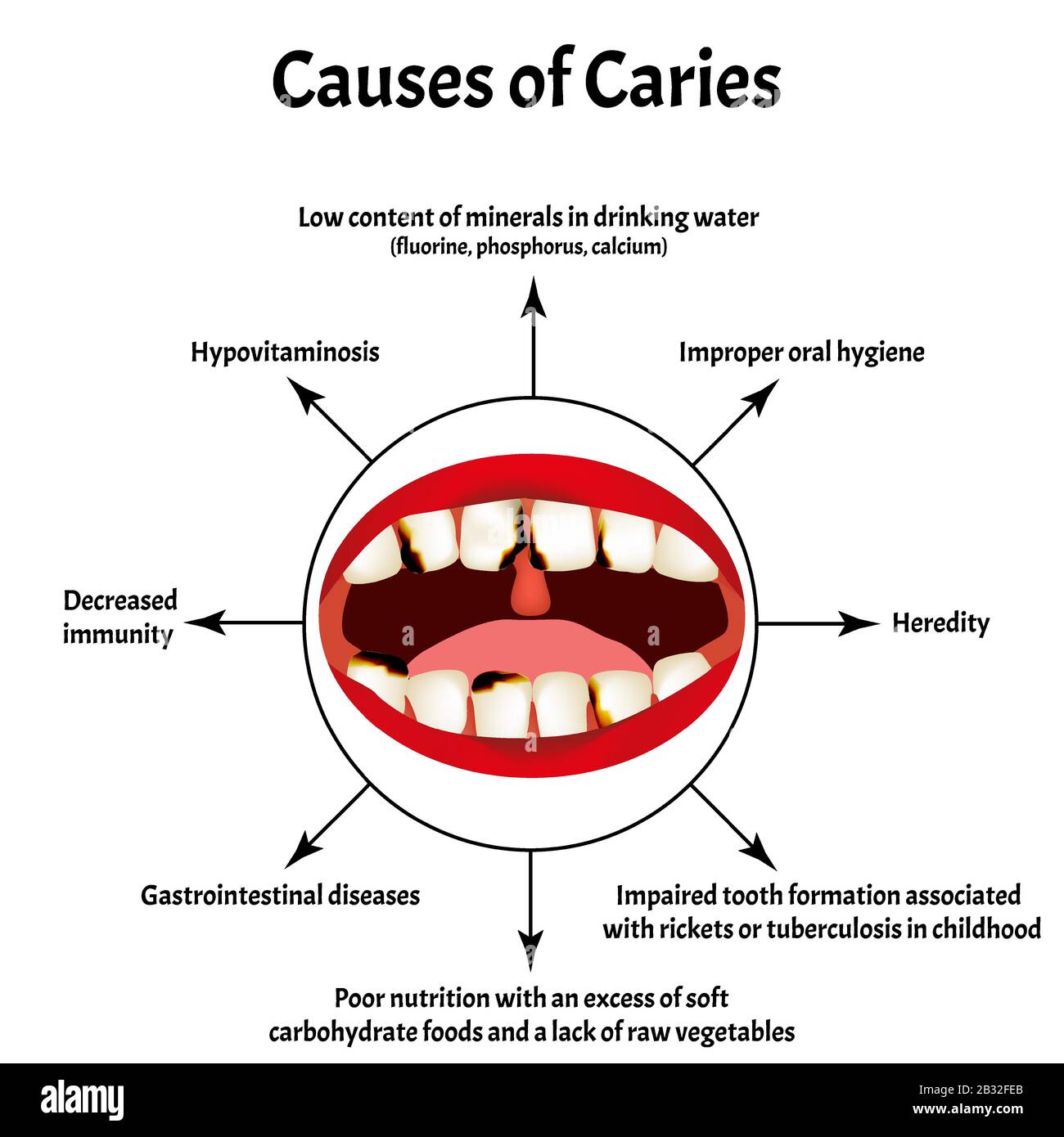 Understanding Dental Caries As A Non Communicable And Behavioral 