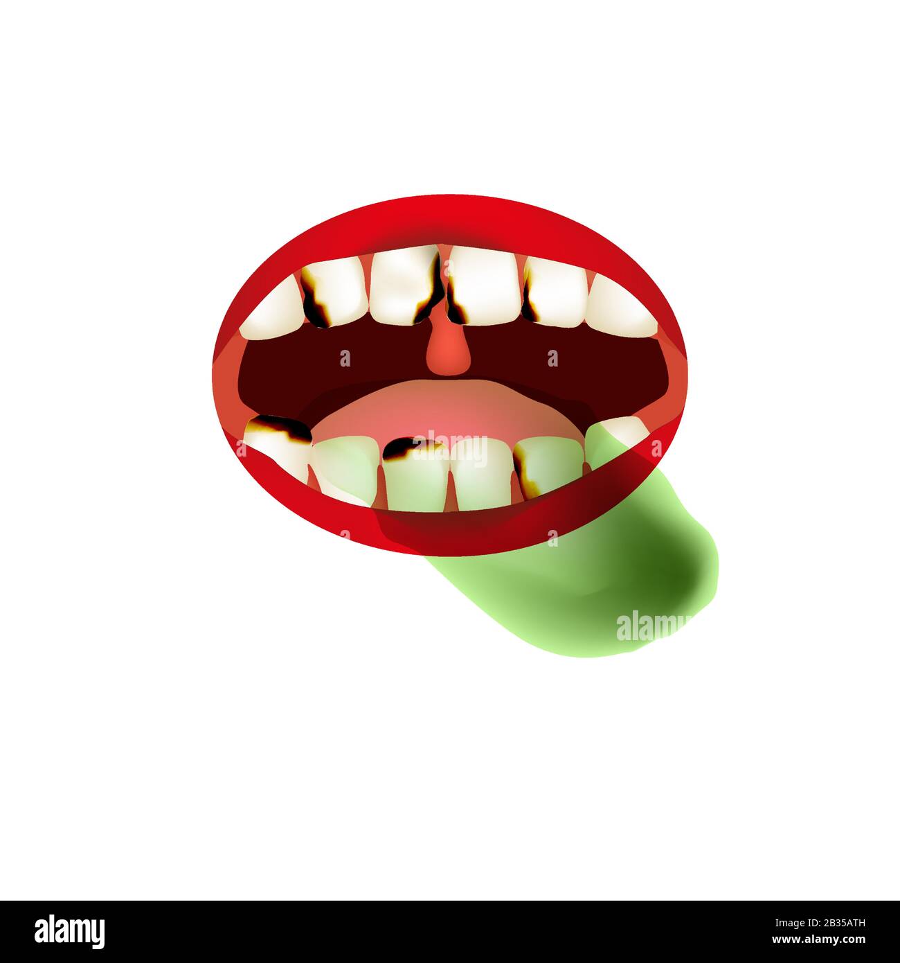 Causes of bad teeth Stock Vector Images - Alamy