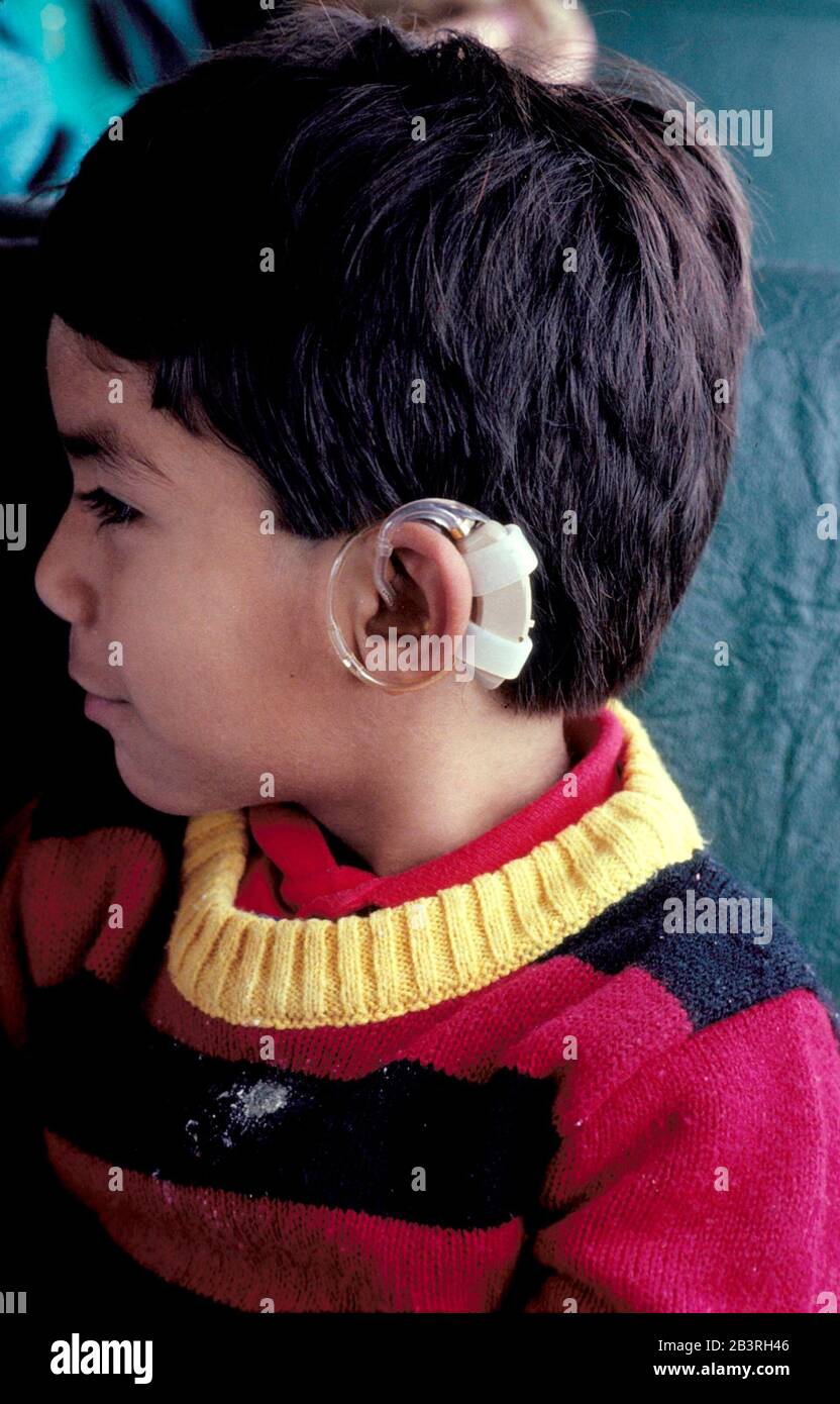 Behind the ear hearing aid child hires stock photography and images Alamy